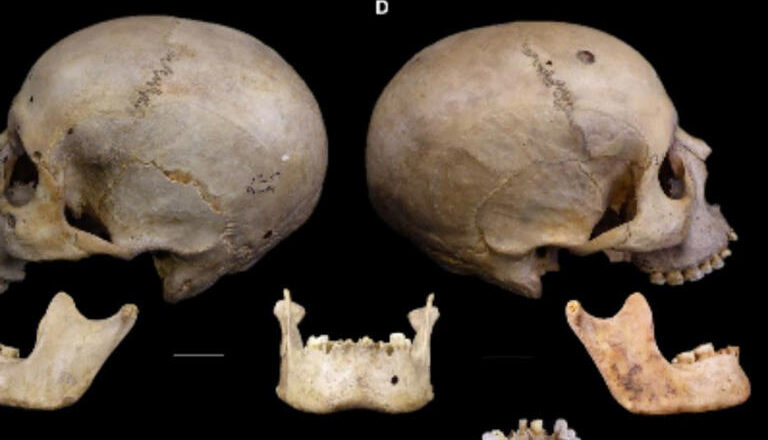 SAI CHE…è stato scoperto come gli antichi Egizi curavano il cancro