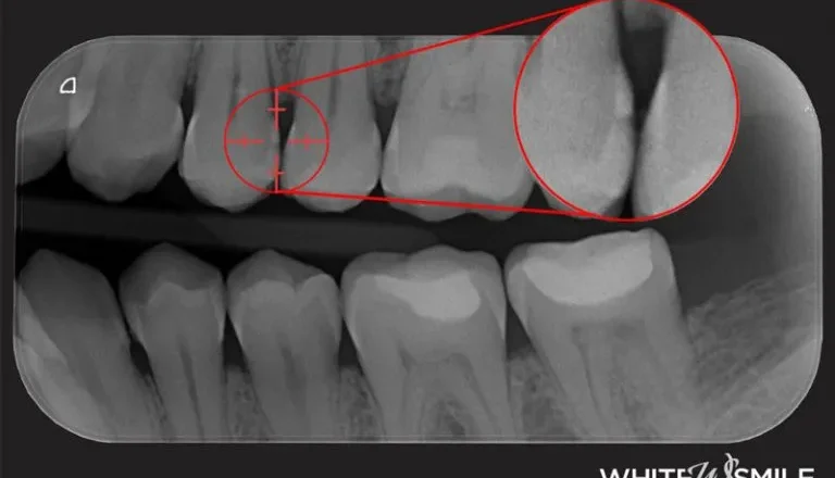 Denti umani e denti animali: tutto quello che non sai