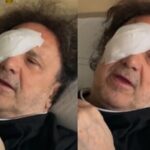 Enzo Avitabile, un nuovo sguardo sulla vita: il trapianto di cornea e l’affetto dei fan